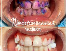 Стоматологическая клиника DentalPark (ДенталПарк), Наши работы - фото 6