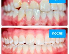 Стоматология Bas dent (Бас дент), Примеры работ - фото 5