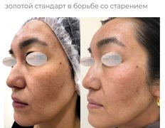 Медицинский центр ANNA Vi CLINICS (Анна Ви Клиникс), Наши работы - фото 20