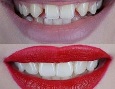 Стоматология Bas dent (Бас дент), Примеры работ - фото 1