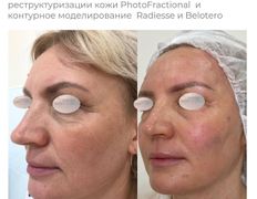 Медицинский центр ANNA Vi CLINICS (Анна Ви Клиникс), Наши работы - фото 16