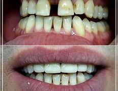 Стоматологическая клиника DentalPark (ДенталПарк), Наши работы - фото 5
