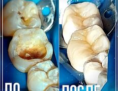 Стоматологическая клиника DentalPark (ДенталПарк), Наши работы - фото 8