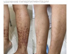 Медицинский центр ANNA Vi CLINICS (Анна Ви Клиникс), Наши работы - фото 10