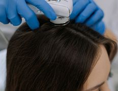 Клиника здоровой кожи SmartDerma (СмартДерма), Трихология - фото 12