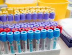 Аллергоцентр DiVera (ДиВера), Divera - фото 13