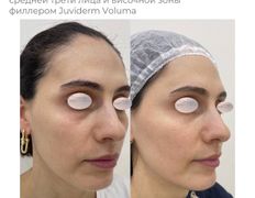 Медицинский центр ANNA Vi CLINICS (Анна Ви Клиникс), Наши работы - фото 7