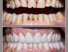 Стоматологическая клиника DentalPark (ДенталПарк), Наши работы - фото 9