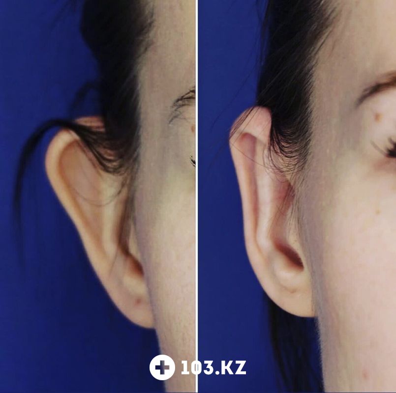Примеры работ Клиника пластической хирургии «Plastika Clinic (Пластика клиник)» - фото 1660823