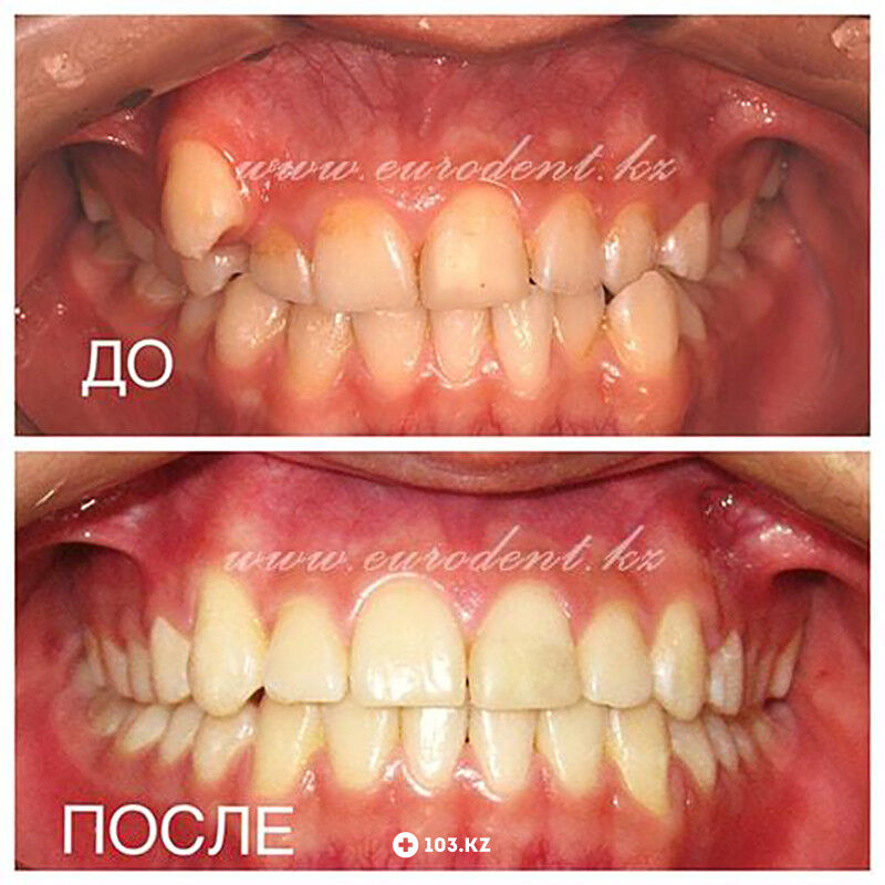 Примеры работ Сеть круглосуточных стоматологических клиник «Eurodent (Евродент)» - фото 1586923