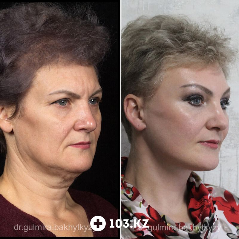 Примеры работ  «Клиника пластической хирургии доктора Кобландина» - фото 1649306