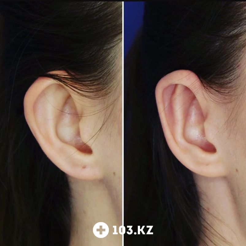 Примеры работ Клиника пластической хирургии «Plastika Clinic (Пластика клиник)» - фото 1660820