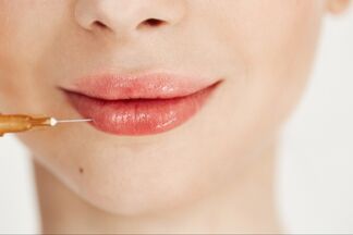 «Чтобы получить эффект «утиных губ», нужно еще постараться», — косметолог про уколы гиалурона