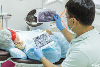 9 мифов о зубных имплантах. Комментирует врач-стоматолог
