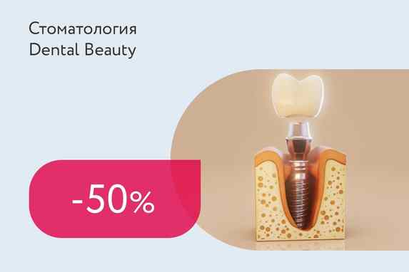 Скидки до 50% на имплантацию и All-on-4