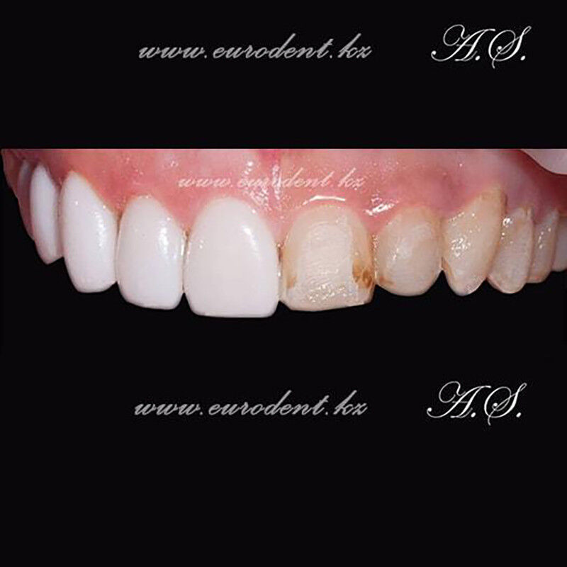 Примеры работ Сеть круглосуточных стоматологических клиник «Eurodent (Евродент)» - фото 1586993