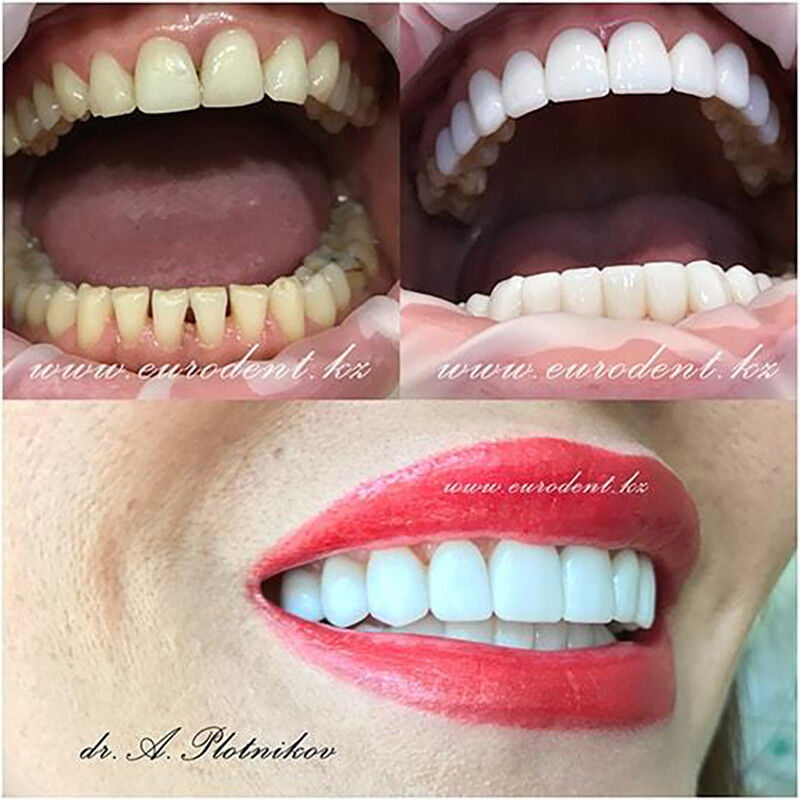 Примеры работ Сеть круглосуточных стоматологических клиник «Eurodent (Евродент)» - фото 1586963