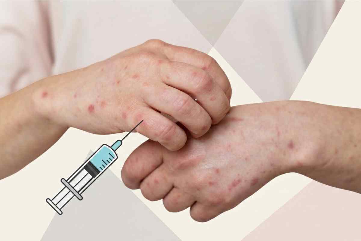 В Казахстане объявили срочную вакцинацию из-за вспышки кори