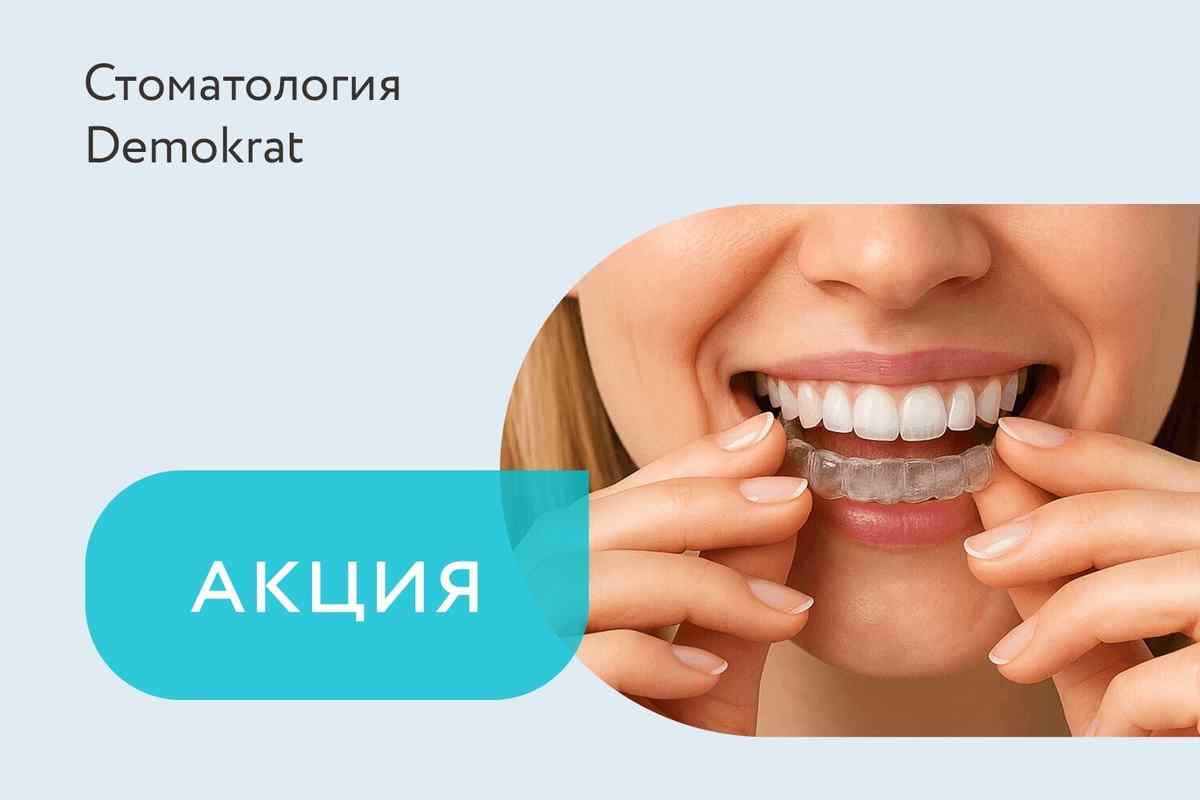 Акция на элайнеры