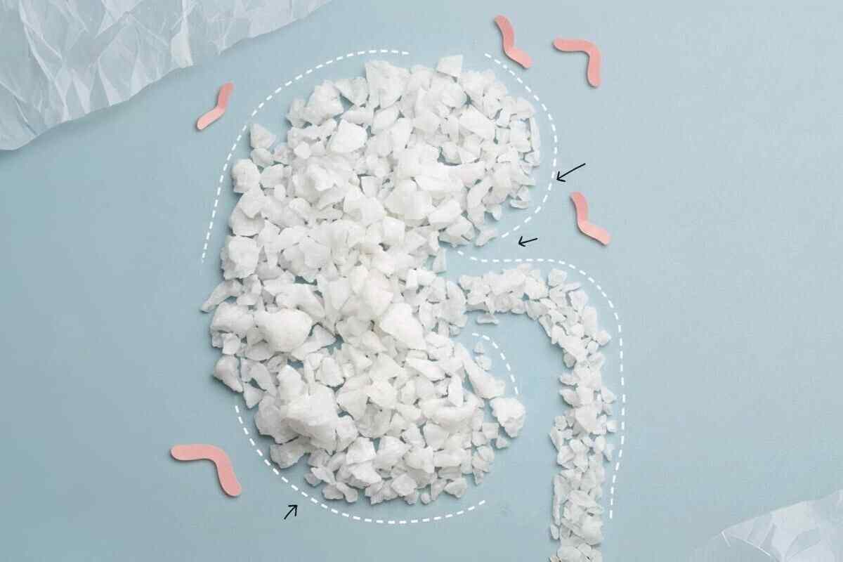 Замешаны бактерии? Ученые обнаружили скрытую причину формирования камней в почках