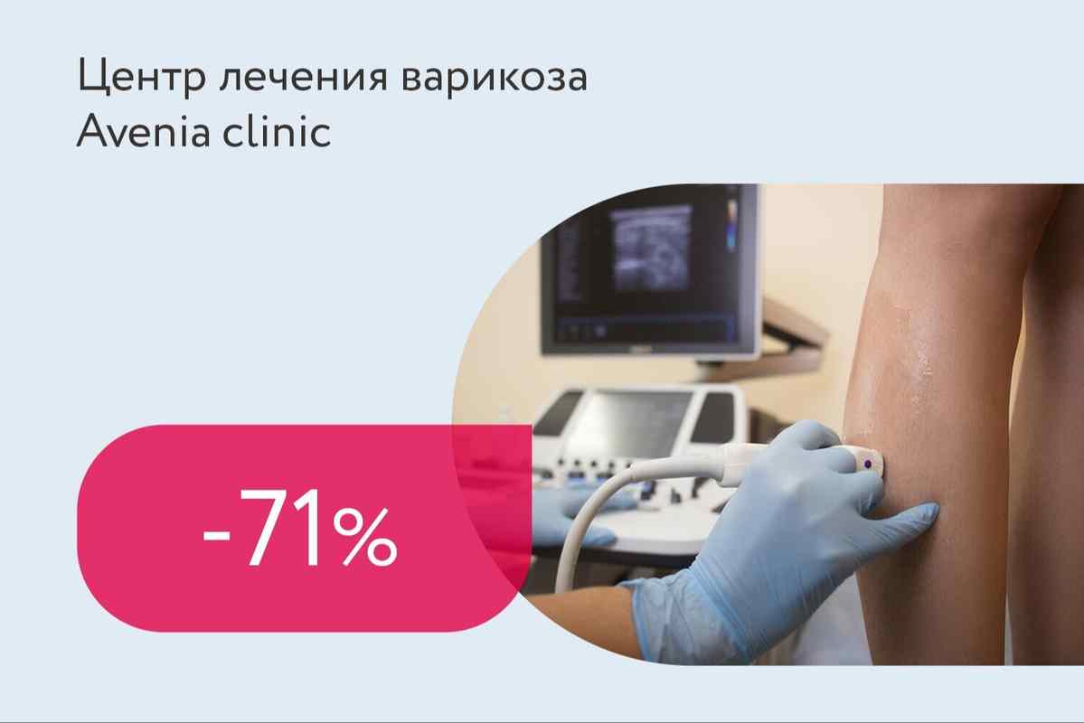 Скидка 71% на диагностику варикоза