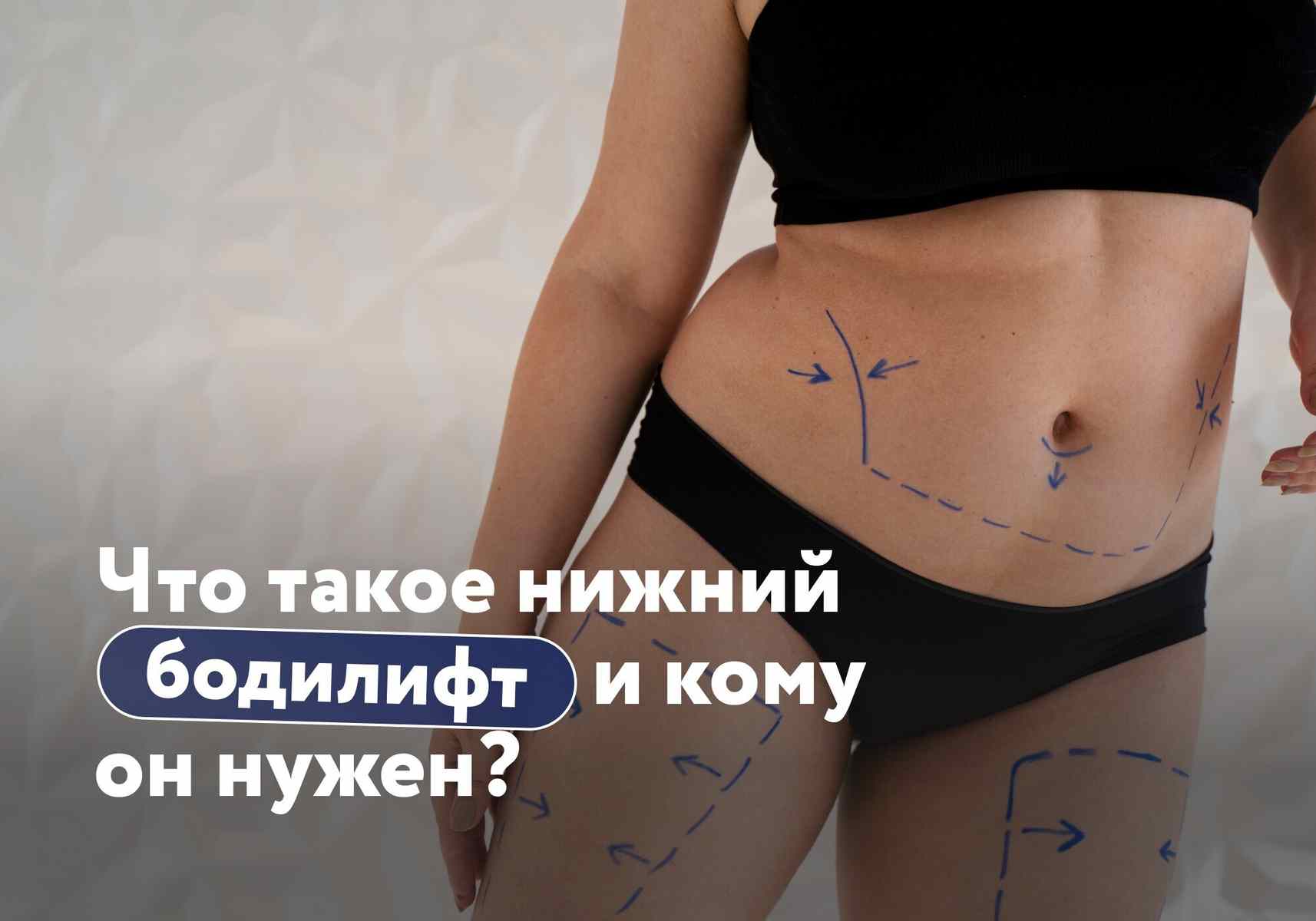 «Доктор, есть вопрос». Нижний бодилифт: кому нужна операция и какого результата ждать?