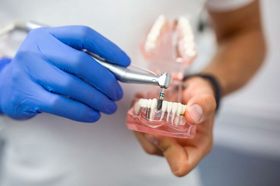 Что такое одномоментная имплантация?