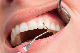 Что лечит пародонтолог?