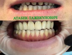 Стоматология AQstom (АКстом), Наши услуги - фото 15