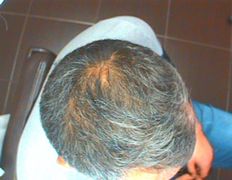 Медицинский центр лечения волос и кожи головы АМД Лаборатории, Примеры работ - фото 7