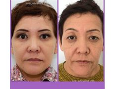 null Клиника пластической хирургии доктора Кобландина, Наши работы - фото 18
