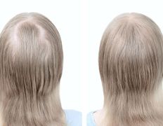 Медицинский центр лечения волос и кожи головы АМД Лаборатории, Примеры работ - фото 5