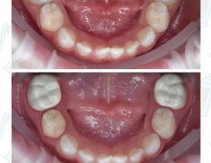 Стоматологический центр Kids Smile (Кидс Смайл), Примеры работ - фото 4