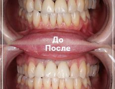 Стоматологическая клиника DentalPark (ДенталПарк), Работы - фото 7