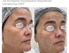 Медицинский центр ANNA Vi CLINICS (Анна Ви Клиникс), Наши работы - фото 1