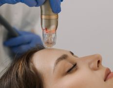 Клиника здоровой кожи SmartDerma (СмартДерма), Аппаратная косметология - фото 9