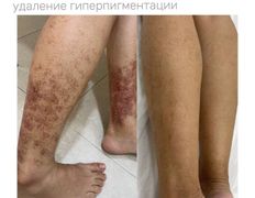 Медицинский центр ANNA Vi CLINICS (Анна Ви Клиникс), Наши работы - фото 11