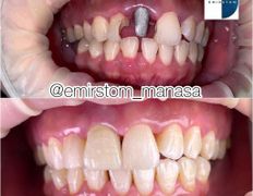 Стоматология AQstom (АКстом), Наши работы - фото 2