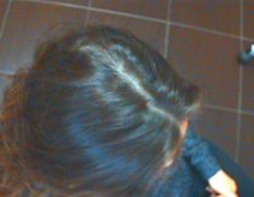 Медицинский центр лечения волос и кожи головы АМД Лаборатории, Примеры работ - фото 20