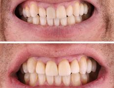 Стоматология My Dent (Май Дент), Примеры работ - фото 2