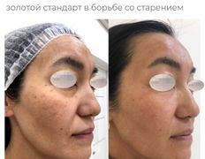 Медицинский центр ANNA Vi CLINICS (Анна Ви Клиникс), Наши работы - фото 19