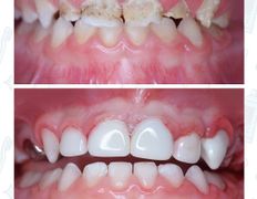 Стоматологический центр Kids Smile (Кидс Смайл), Примеры работ - фото 6