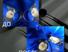 Стоматология Зуб`ОК, Наши работы - фото 5