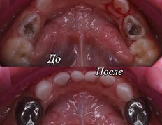 Стоматология One Dent (Уан Дент), Примеры работ - фото 2