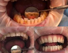 Стоматология AQstom (АКстом), Наши услуги - фото 11