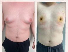 Медицинский центр Ultraline (Ультралайн), До/После - фото 3