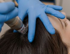 Клиника здоровой кожи SmartDerma (СмартДерма), Аппаратная косметология - фото 6