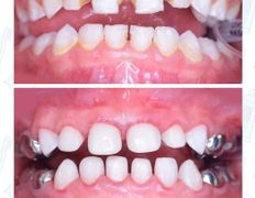 Стоматологический центр Kids Smile (Кидс Смайл), Примеры работ - фото 1