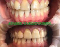 Стоматология AQstom (АКстом), Наши услуги - фото 14