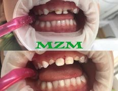 Стоматология AQstom (АКстом), Наши услуги - фото 17